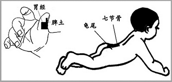 小兒便秘推拿