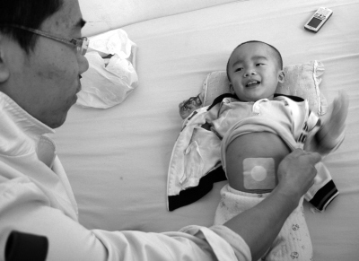 藥貼治療小兒慢性腹瀉