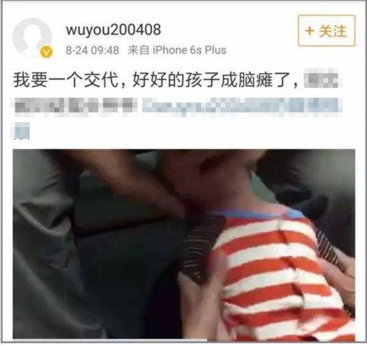小兒推拿與腦癱