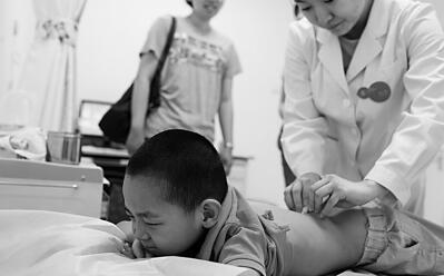 小兒捏脊